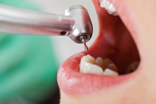 Best Emergency Treatment for Oral Infections in Truman, MN